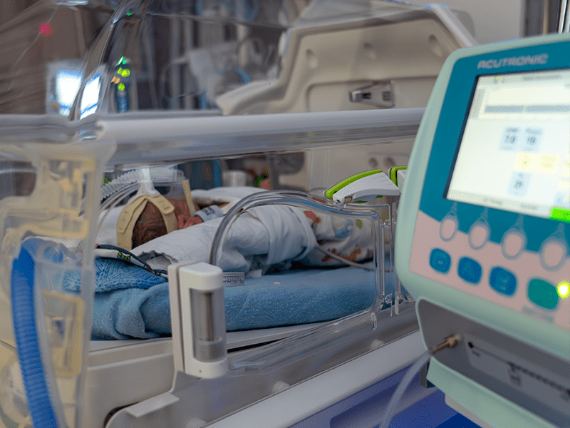 Photo: A newborn baby in the NICU with CPAP