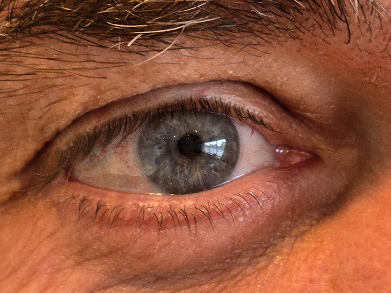 Photo: Closeup of Dr. Ian Digby's eye
